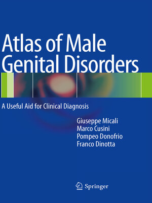 cover image of Atlas of Male Genital Disorders